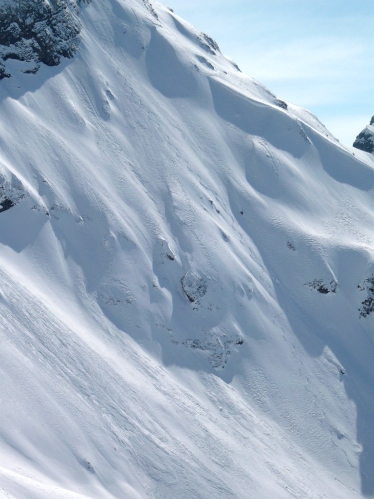 Partie inférieure de la face N