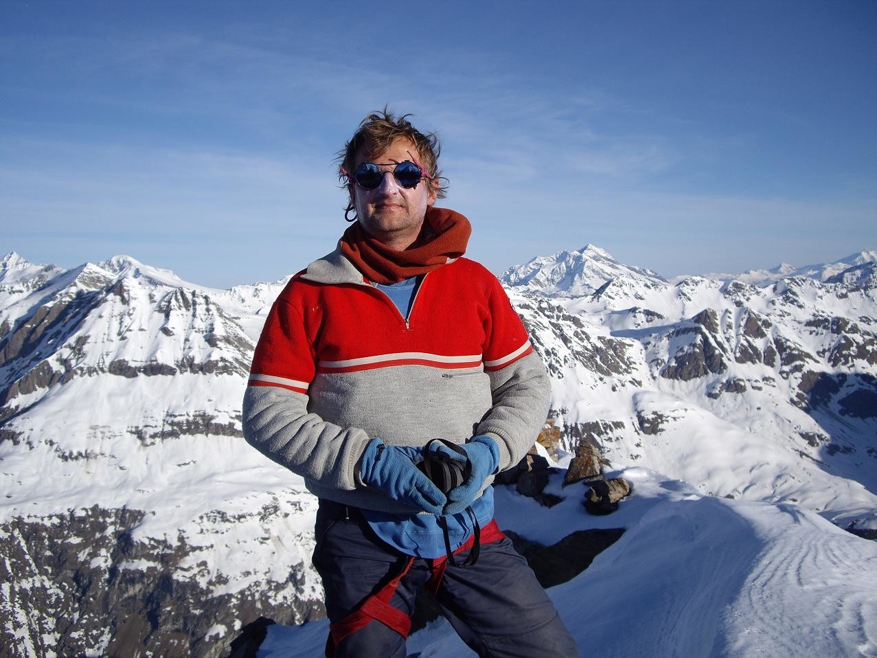 Moi en y a etre moche et mal peigné