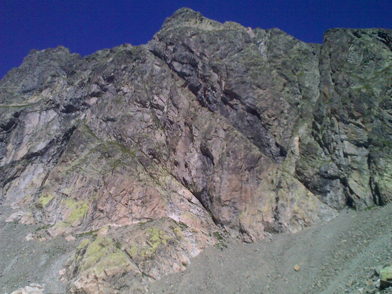 Vue d'ensemble de la face