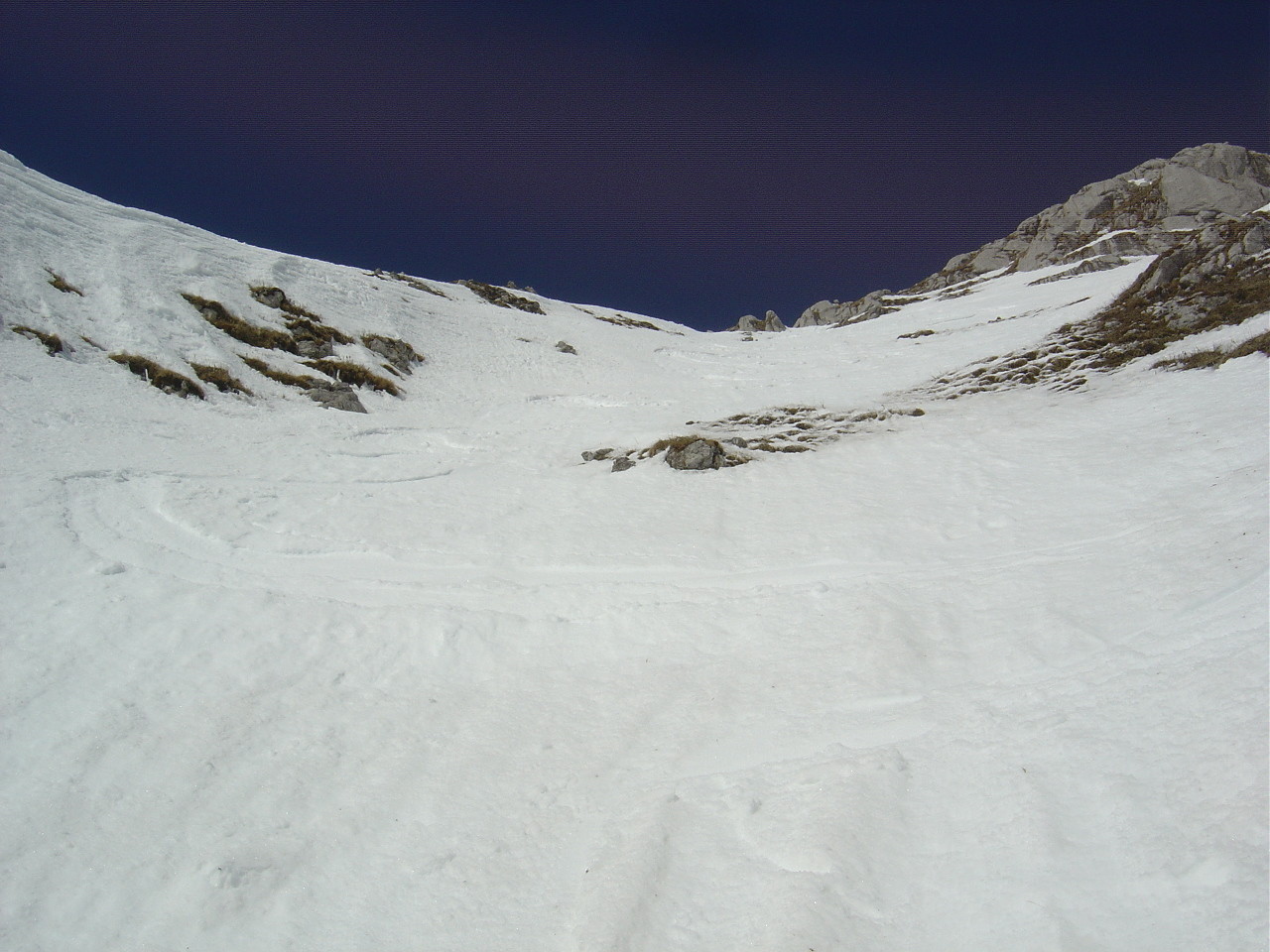 Le haut de la face