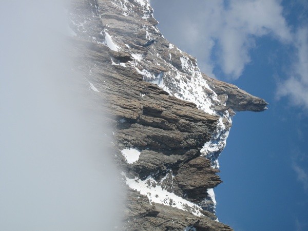 dent
