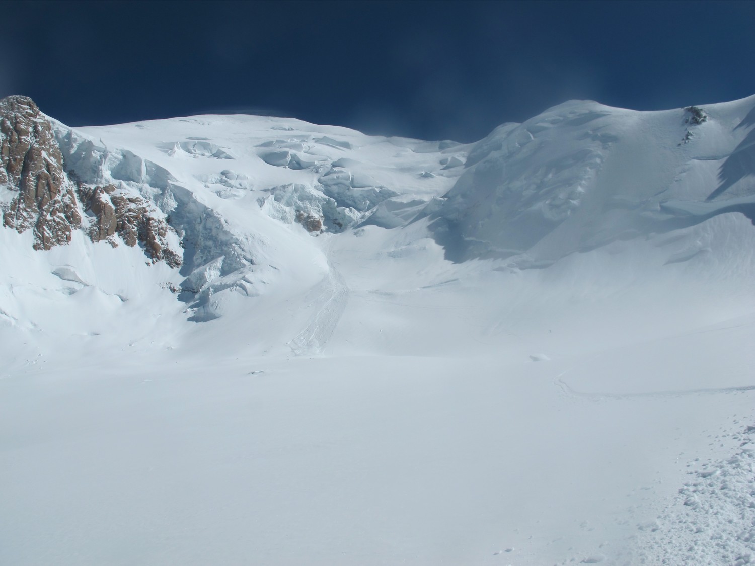 vue globale