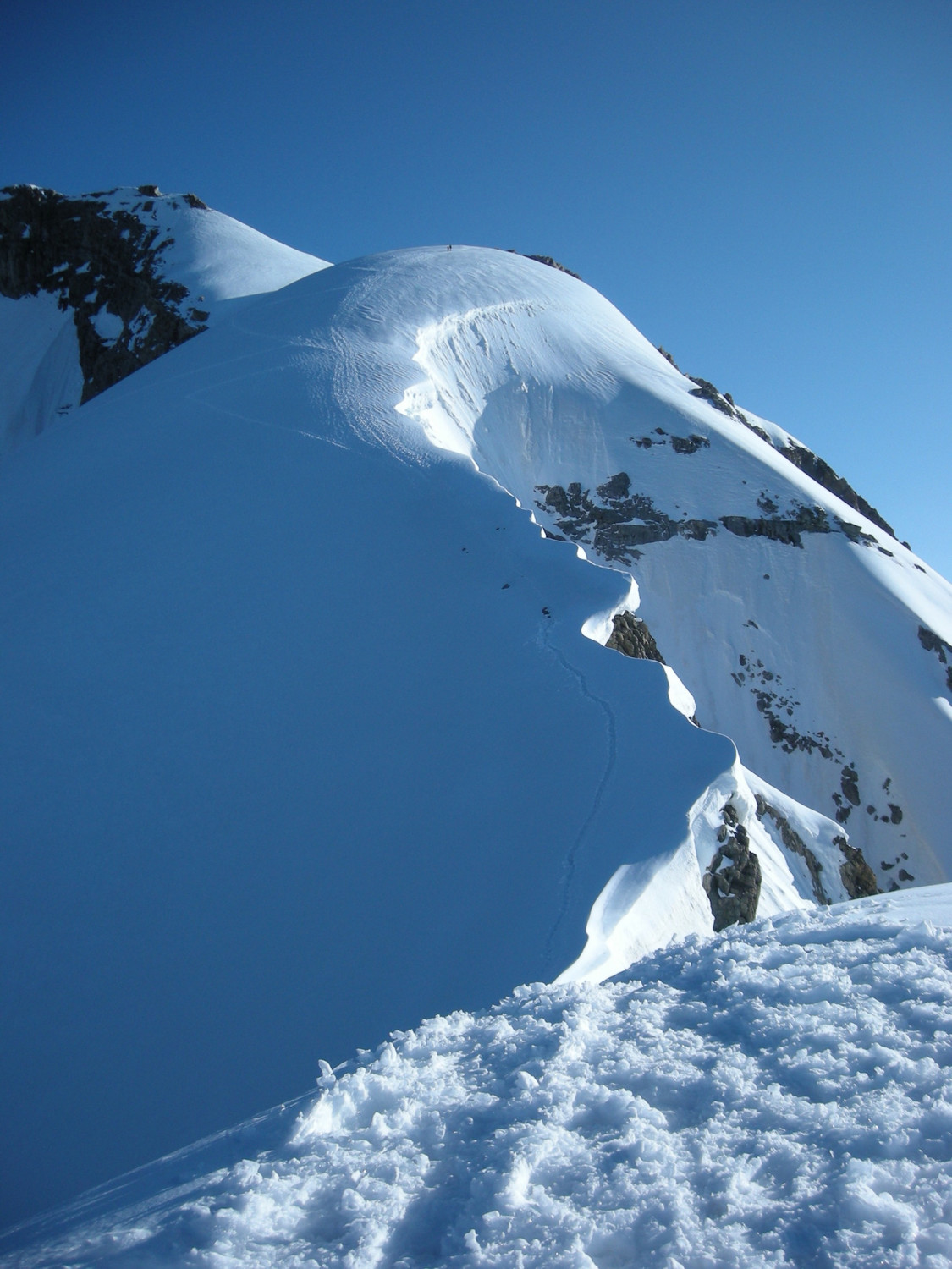 arete superieure